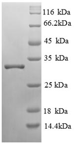 Human LRBA protein