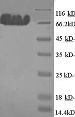 Rat Mapt protein
