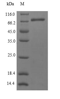 Human METAP2 protein