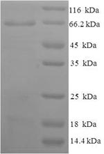 Human NPRA protein