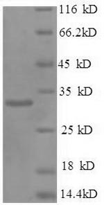 Human PHB protein