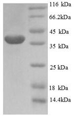 Human PHF5A protein