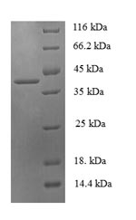 Human PHPT1 protein