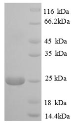 Bovine PIGR protein