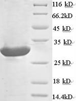 Rat Pla2g5 protein