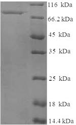 Human PLAT protein