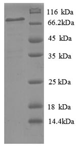 Human PLTP protein