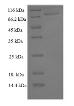 Human PPARG protein