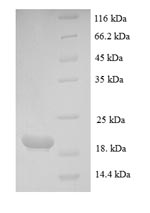 Human PTHLH protein