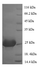 Human PVALB protein
