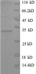 Human PYCR1 protein