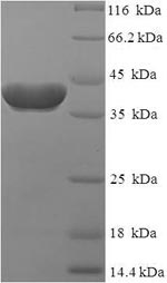 Human RAB2A protein