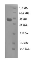 Human REG3A protein