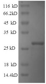 Human RELN protein