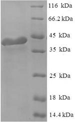 Human RGS2 protein