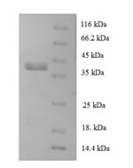 Human RPL28 protein