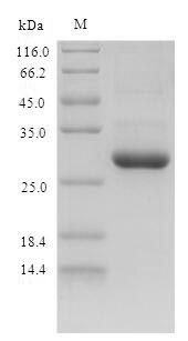 Mouse S100a9 protein