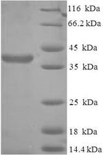 Human SCO2 protein