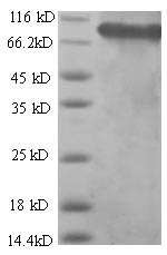 Human SDHA protein
