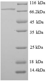 Rat PEDF protein