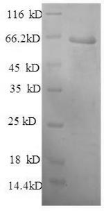 Mouse SERPING1 protein