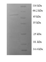 Human SFN protein