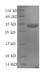 Human SRSF1 protein