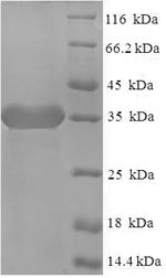 Human SIRPD protein