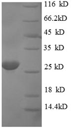 Human SIVA1 protein