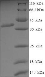 Mouse Slc1a2 protein