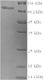 Human SMARCA2 protein