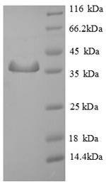 Human SMCP protein