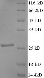 Human SNAP25 protein