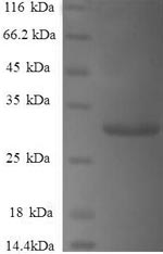 Human SNCG protein