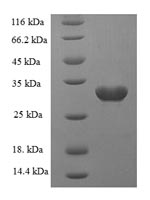 Rat Sort1 protein