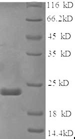 Mouse Sry Tdf Tdy protein