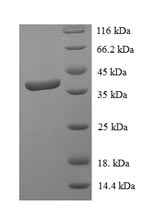 Human STAT3 protein