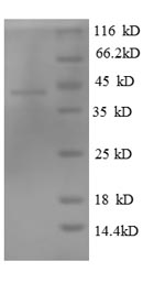 Human TBCC protein