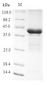 Human TESC protein