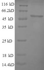 Human TK protein
