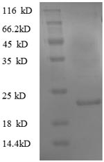 Mouse Tpt1 protein