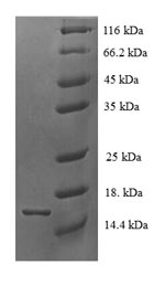 Human TSPAN7 protein
