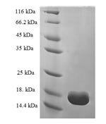 Human Transthyretin protein