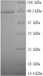 Human TUBB2A protein