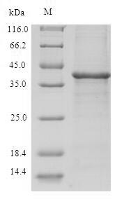 Human TXNDC17 protein