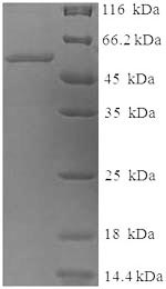 Human TYR protein