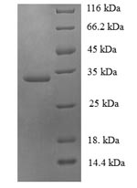 Human UBE2V2 protein