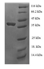 Human USF1 protein