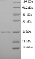 Human VAMP7 protein