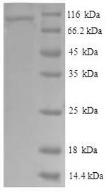 Human VCAM1 protein